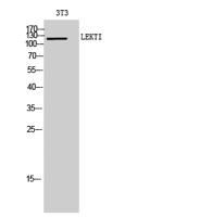 LEKTI Polyclonal Antibody