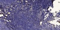 LEKTI Polyclonal Antibody