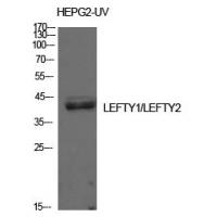 Lefty Polyclonal Antibody