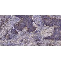 Lefty Polyclonal Antibody