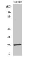 LDOC1L Polyclonal Antibody