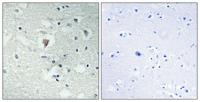 LDOC1L Polyclonal Antibody
