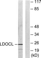 LDOC1L Polyclonal Antibody