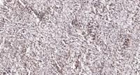 LDOC1 Polyclonal Antibody