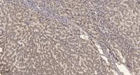 LDLRAD3 Polyclonal Antibody