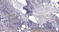 LDLRAD1 Polyclonal Antibody