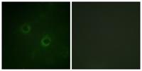 Lck Polyclonal Antibody