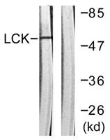 Lck Polyclonal Antibody