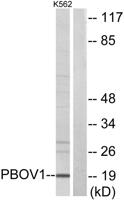 UROC28 Polyclonal Antibody