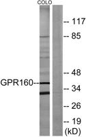 GPR160 Polyclonal Antibody