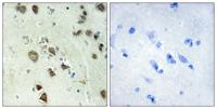 Rsk-4 Polyclonal Antibody