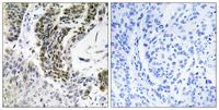 RREB1 Polyclonal Antibody