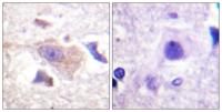 GRB10 Polyclonal Antibody