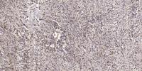 GRB14 Polyclonal Antibody