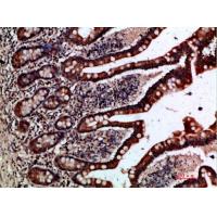 Gremlin-2 Polyclonal Antibody