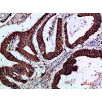 Gremlin-2 Polyclonal Antibody