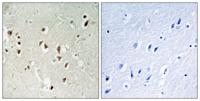 GRF-1 Polyclonal Antibody