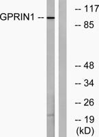GRIN1 Polyclonal Antibody