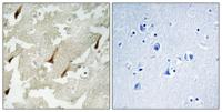 GRIN2 Polyclonal Antibody