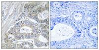 GRIN2 Polyclonal Antibody