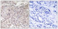 GRIN3 Polyclonal Antibody