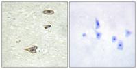 GRK 1 Polyclonal Antibody