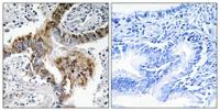 GRK 2 Polyclonal Antibody