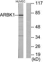 GRK 2 Polyclonal Antibody