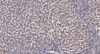 GRK 4 Polyclonal Antibody