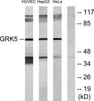 GRK 5 Polyclonal Antibody