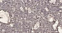 GRK 5 Polyclonal Antibody