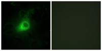 GRK 6 Polyclonal Antibody