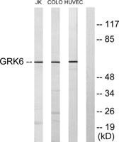 GRK 6 Polyclonal Antibody