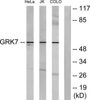 GRK 7 Polyclonal Antibody