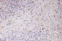 GROα Polyclonal Antibody
