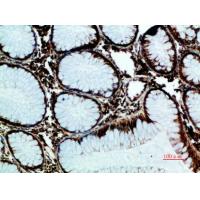GRP78 BiP Polyclonal Antibody