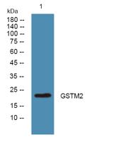 GSTM2 Polyclonal Antibody