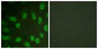 RUNX1 Polyclonal Antibody