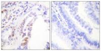 RUNX1 Polyclonal Antibody