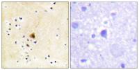 RyR-2 Polyclonal Antibody