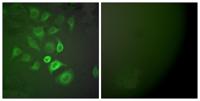 S-100 α Polyclonal Antibody