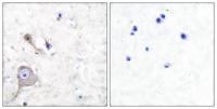 S-100 α Polyclonal Antibody