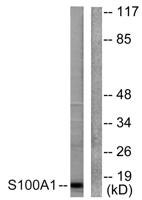 S-100 α Polyclonal Antibody