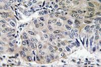 S-100A10 Polyclonal Antibody