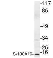 S-100A10 Polyclonal Antibody
