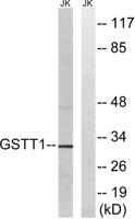 GSTT1/4 Polyclonal Antibody
