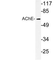 AChE Polyclonal Antibody