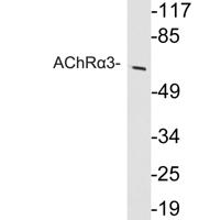 AChRα3 Polyclonal Antibody