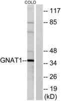 Gα t1 Polyclonal Antibody