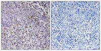 HCCS Polyclonal Antibody